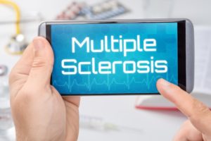 101172370-Zerbor-Dreamstime-INP-Instituut-voor-Neuropathische-Pijn ms en neuropathie