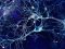 Koude Multifocale Motorische Neuropathie (MMN)