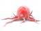 Paclitaxel and long-lasting sensory neuropathy