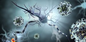 50857843-Ralwel-Dreamstime-INP-Instituut-voor-Neuropathische-Pijn bortezomib ployneuropathie