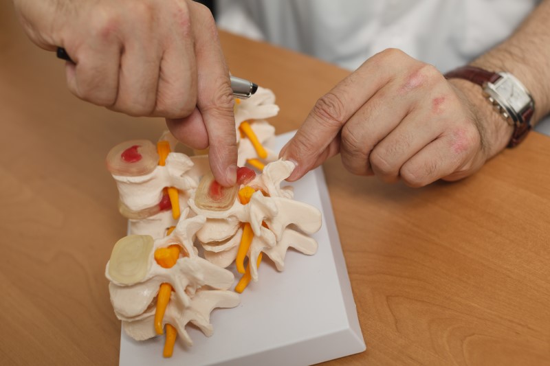 92585620-Gennady-Danilkin-Dreamstime-INP-Instituut-voor-Neuropathische-Pijn zenuwwortel