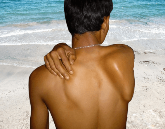 INP-scapula-alata.png