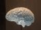 Wat is centrale CVA neuropathische pijn?