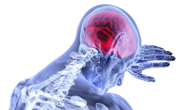 pixabay-3168269-INP-Instituut-voor-Neuropathische-Pijn