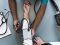 Diagnose neuropathie bij de neuroloog